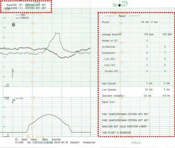 Καρδιοτοκογράφος Smart 3 - Image 4