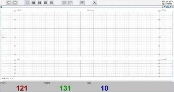 Καρδιοτοκογράφος Smart 3 - Image 6