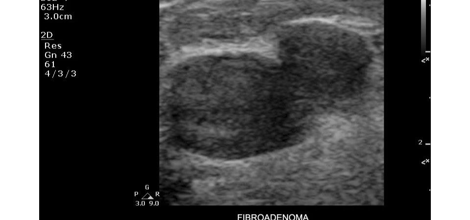 Υπέρηχος Clearvue 350 - Image 2