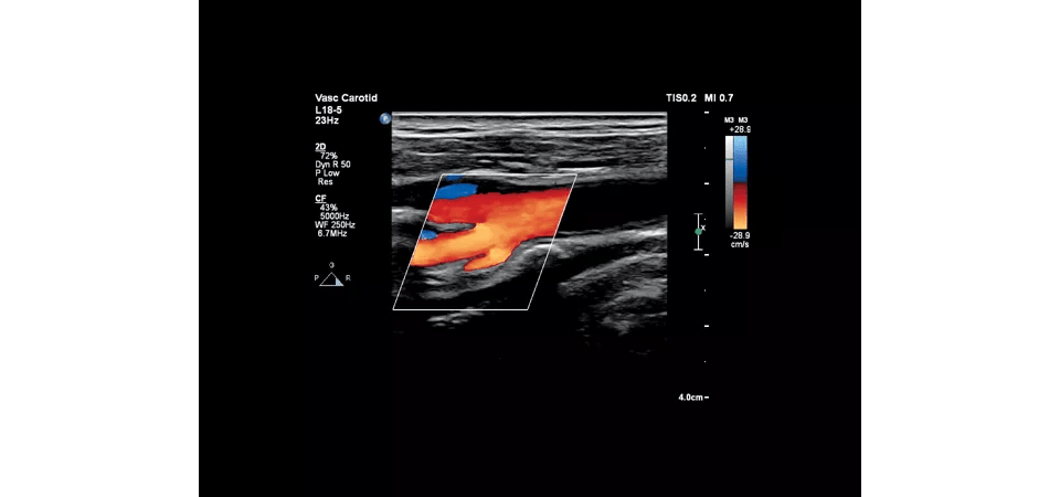 Υπέρηχος Affiniti 70GI - Image 3