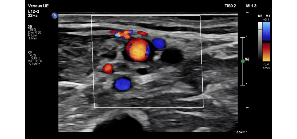 Υπέρηχος Affiniti 70GI - Image 4