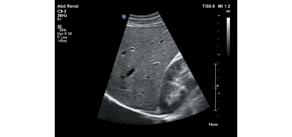 Υπέρηχος Affiniti 70GI - Image 5