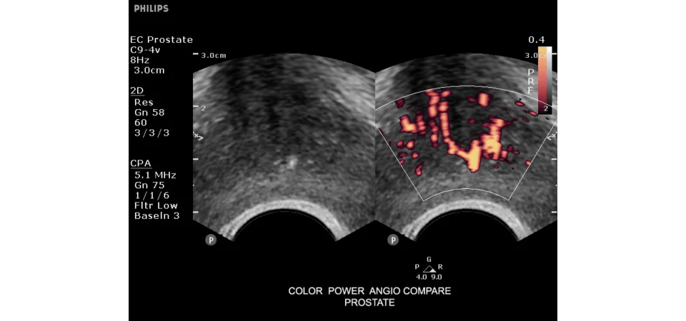 Υπέρηχος Clearvue 350 - Image 5