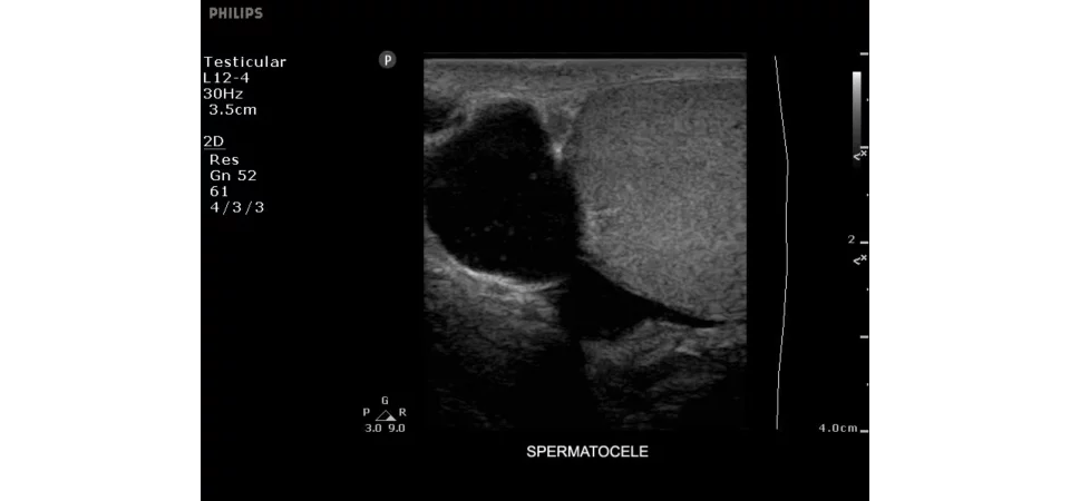 Υπέρηχος Clearvue 350 - Image 4