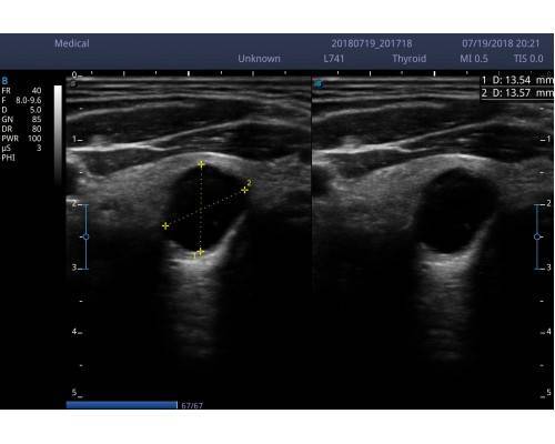 Υπέρηχος Sonoscape E2 - Image 3