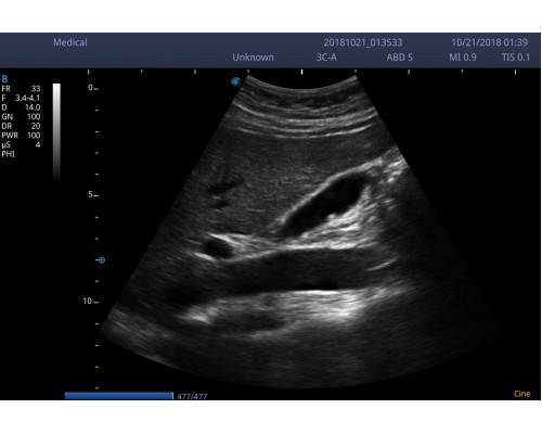 Υπέρηχος Sonoscape E2 - Image 5