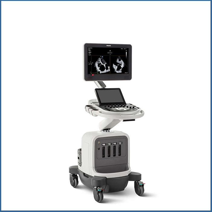 Υπέρηχος Affiniti CVx