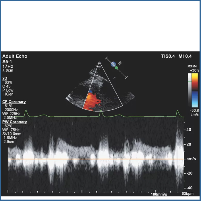 Υπέρηχος Affiniti CVx - Image 3
