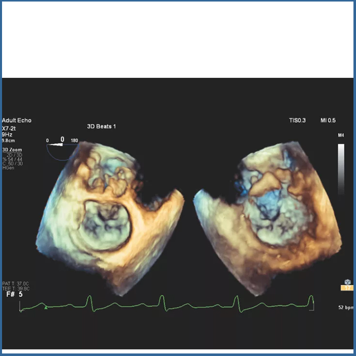 Υπέρηχος Affiniti CVx - Image 4
