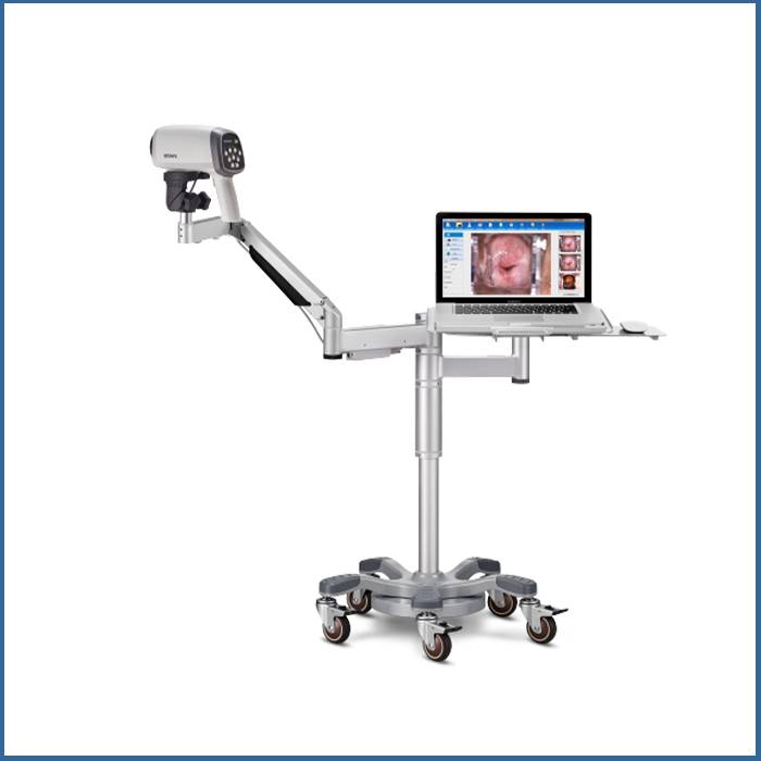 Βίντεο Κολποσκόπιο C6A Led Edan + Software - Image 3